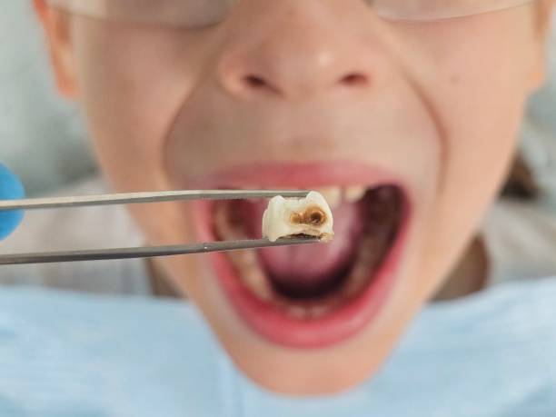 Best Weekend Emergency Dentist in Mayville, MI